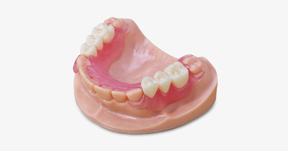 Dental Crown