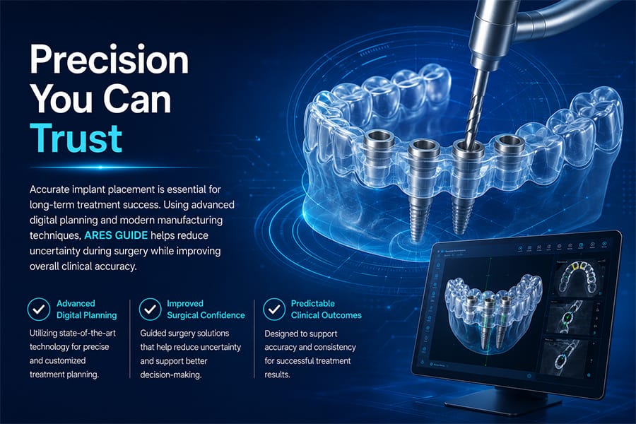 Digital Implant Planning
